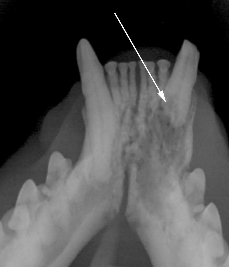 x-ray of mandible